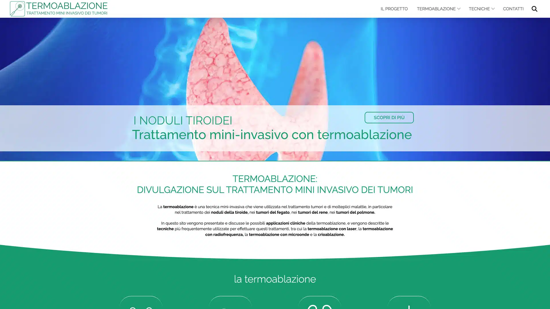 Featured image for “Termoablazione”